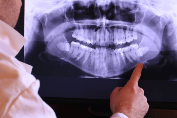 Best Emergency Dental Services for Seniors in Gibsonton, FL